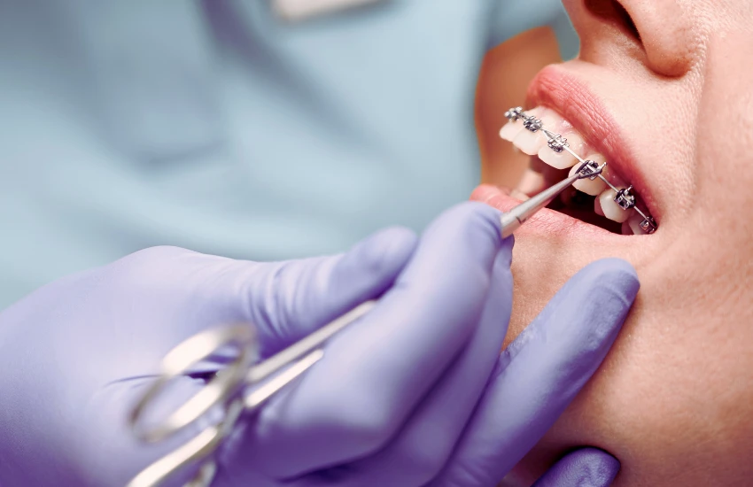 Ortodontia com Aparelhos