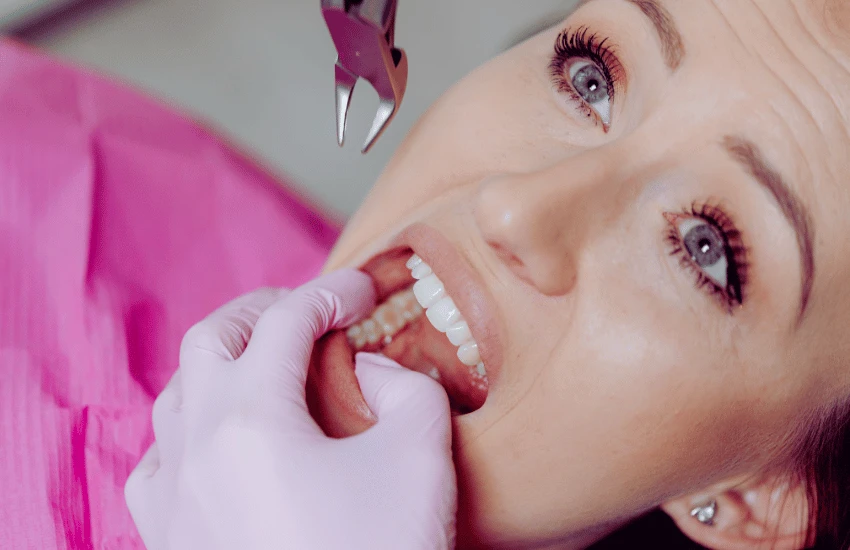 Extração dentária